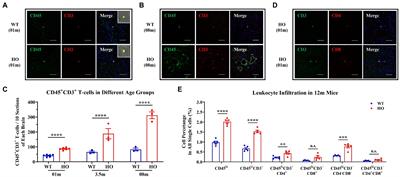 T-cell infiltration in the central nervous system and their association with brain calcification in Slc20a2-deficient mice